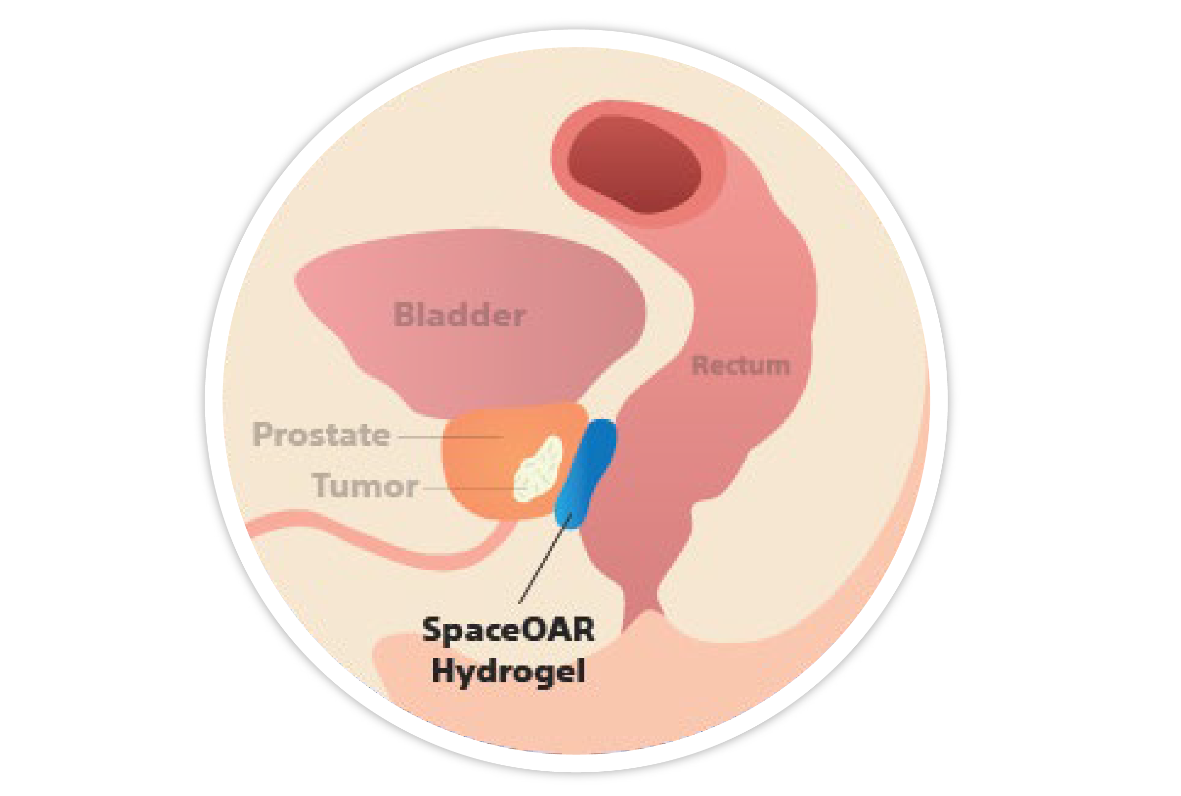 Anatomía sin SpaceOAR