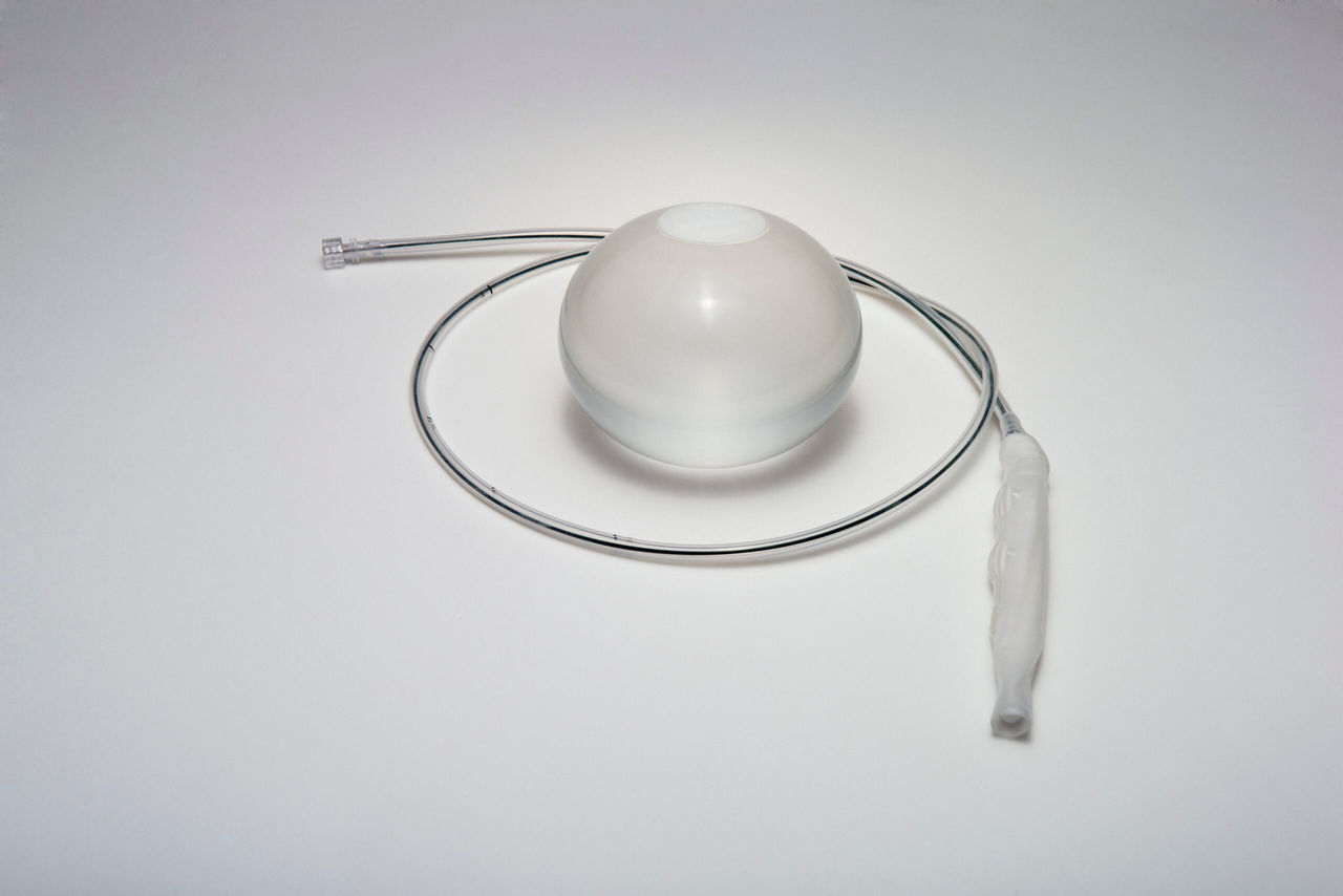 Gastroplastia endoscópica en manga (ESG)