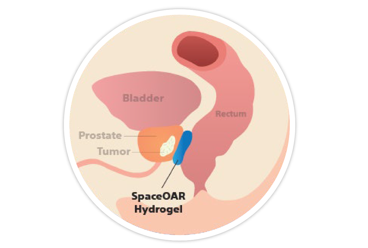 Anatomía sin SpaceOAR